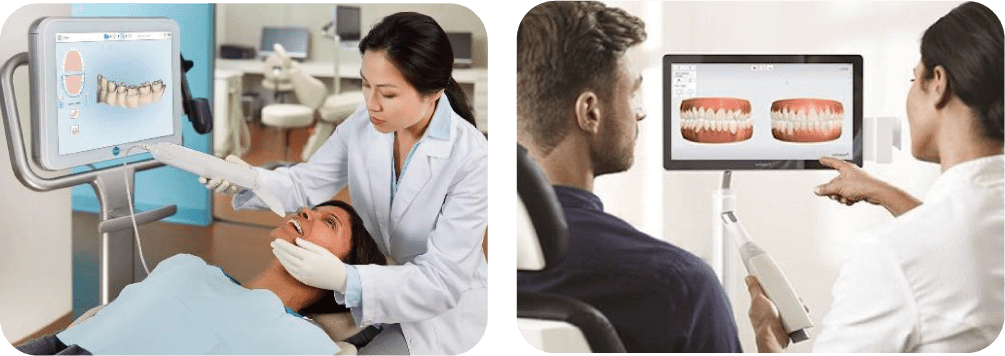 3D光学スキャナーイメージ