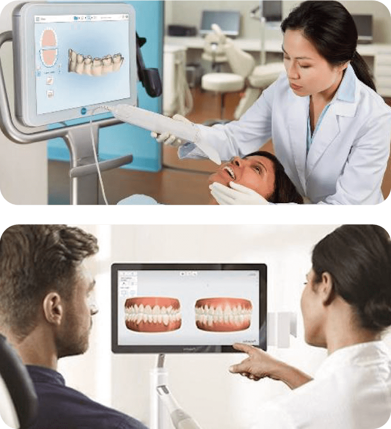 3D光学スキャナーイメージ