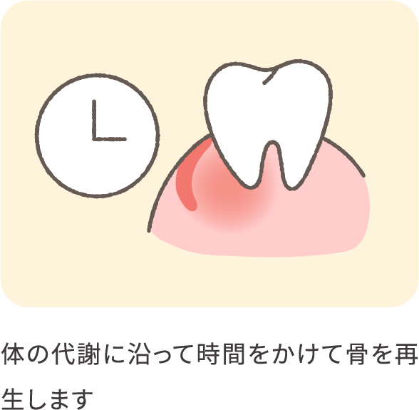 implant-GTR-05_pc@2x-min